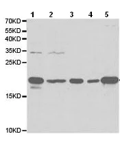 Western blot - Anti-Ferritin Light Chain antibody (AB186871)