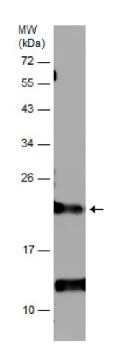 Western blot - Anti-Ferritin Light Chain antibody (AB229784)