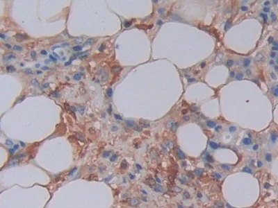Immunohistochemistry (Formalin/PFA-fixed paraffin-embedded sections) - Anti-Ferritin Light Chain antibody (AB232752)