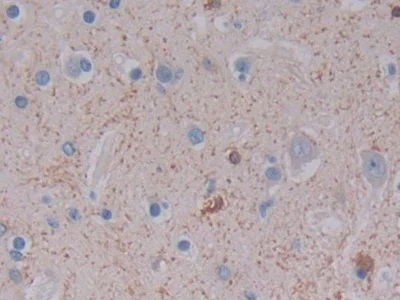 Immunohistochemistry (Formalin/PFA-fixed paraffin-embedded sections) - Anti-Ferritin Light Chain antibody (AB232752)