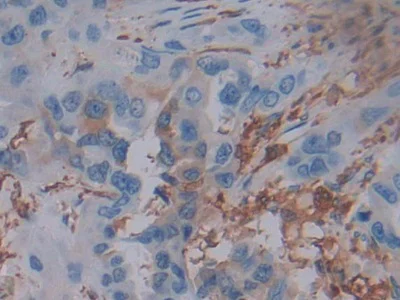 Immunohistochemistry (Formalin/PFA-fixed paraffin-embedded sections) - Anti-Ferritin Light Chain antibody (AB232752)