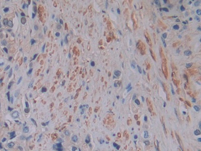 Immunohistochemistry (Formalin/PFA-fixed paraffin-embedded sections) - Anti-Ferritin Light Chain antibody (AB232752)