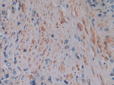 Immunohistochemistry (Formalin/PFA-fixed paraffin-embedded sections) - Anti-Ferritin Light Chain antibody (AB232752)