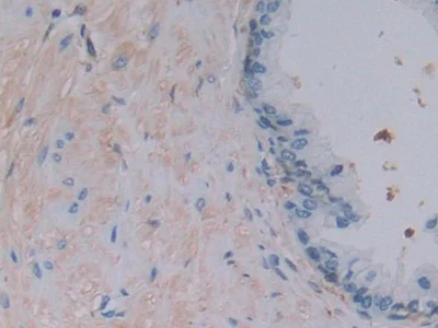 Immunohistochemistry (Formalin/PFA-fixed paraffin-embedded sections) - Anti-Ferritin Light Chain antibody (AB232752)
