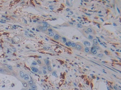Immunohistochemistry (Formalin/PFA-fixed paraffin-embedded sections) - Anti-Ferritin Light Chain antibody (AB232752)