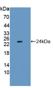 Western blot - Anti-Ferritin Light Chain antibody (AB232752)