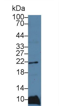 Western blot - Anti-Ferritin Light Chain antibody (AB232752)