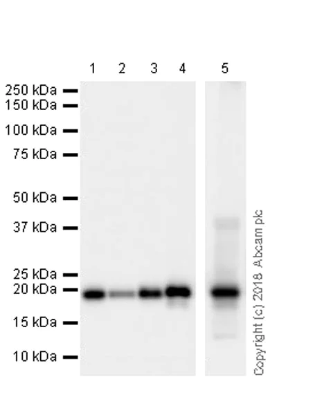Western blot - Anti-Ferritin Light Chain antibody [CPT-R10-58-11] (AB243096)