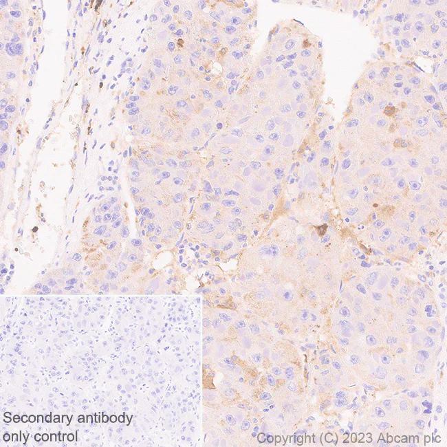 Immunohistochemistry (Formalin/PFA-fixed paraffin-embedded sections) - Anti-Ferritin Light Chain antibody [EPR26117-110] - BSA and Azide free (AB313564)