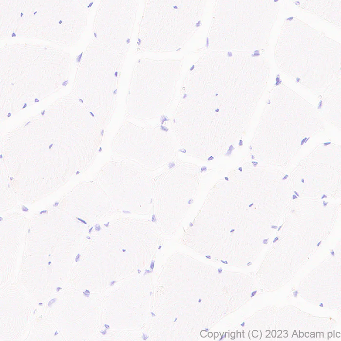 Immunohistochemistry (Formalin/PFA-fixed paraffin-embedded sections) - Anti-Ferritin Light Chain antibody [EPR26117-110] - BSA and Azide free (AB313564)