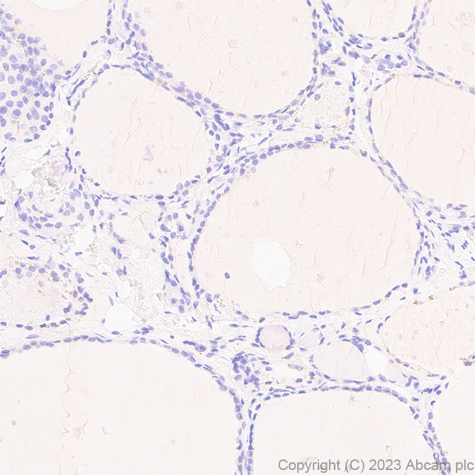 Immunohistochemistry (Formalin/PFA-fixed paraffin-embedded sections) - Anti-Ferritin Light Chain antibody [EPR26117-110] - BSA and Azide free (AB313564)