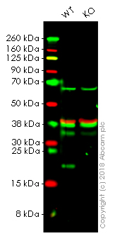 Western blot - Anti-Ferritin Light Chain antibody [EPR5260] (AB109373), expandable thumbnail