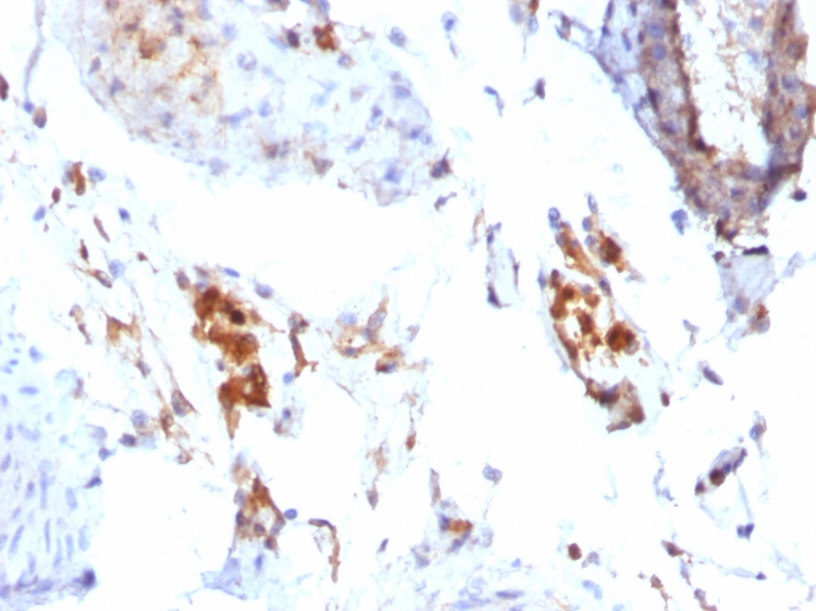 Immunohistochemistry (Formalin/PFA-fixed paraffin-embedded sections) - Anti-Ferritin Light Chain antibody [FTL/1386] (AB218400), expandable thumbnail