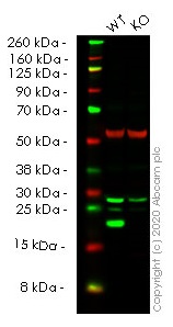 Western blot - Anti-Ferritin Light Chain antibody [FTL/1386] (AB218400), expandable thumbnail