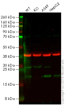 Western blot - Anti-Ferritin Light Chain antibody [FTL/1386] (AB218400)