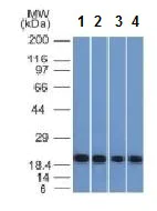 Western blot - Anti-Ferritin Light Chain antibody [FTL/1386] (AB218400)