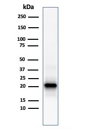 Western blot - Anti-Ferritin Light Chain antibody [FTL/1386] (AB218400), expandable thumbnail
