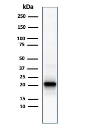 Western blot - Anti-Ferritin Light Chain antibody [FTL/1386] (AB218400)