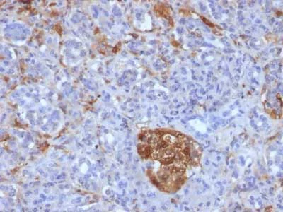 Immunohistochemistry (Formalin/PFA-fixed paraffin-embedded sections) - Anti-Ferritin Light Chain antibody [FTL/1386] - BSA and Azide free (AB218866)