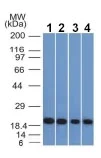 Western blot - Anti-Ferritin Light Chain antibody [FTL/1386] - BSA and Azide free (AB218866)