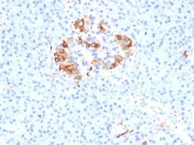 Immunohistochemistry (Formalin/PFA-fixed paraffin-embedded sections) - Anti-Ferritin Light Chain antibody [FTL/1389] - BSA and Azide free (AB218868)