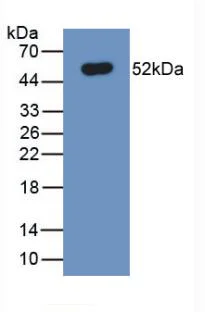 Western blot - Anti-Ferroportin antibody [C2] (AB239583)