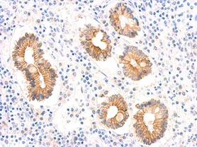 Immunohistochemistry (Formalin/PFA-fixed paraffin-embedded sections) - Anti-Ferroptosis suppressor protein 1 antibody - N-terminal (AB155326)