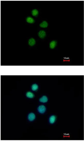 Immunocytochemistry/ Immunofluorescence - Anti-FES antibody (AB153841)