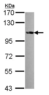 Western blot - Anti-FES antibody (AB153841)