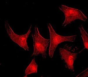 Immunocytochemistry/ Immunofluorescence - Anti-FES antibody [EPR3230(2)] (AB108418)