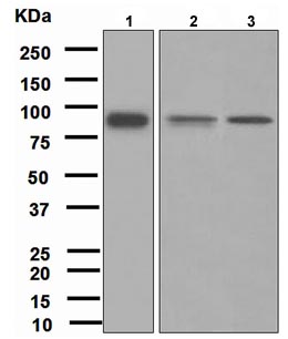 Western blot - Anti-FES antibody [EPR3230(2)] (AB108418), expandable thumbnail