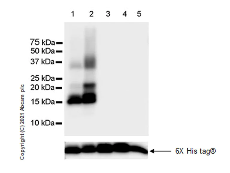 Western blot - Anti-fetal hemoglobin antibody [EPR23381-254] - BSA and Azide free (AB283333)