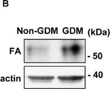 Western blot - Anti-Fetuin A antibody [EPR9291] (AB137125)