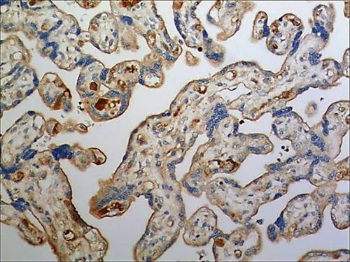 Immunohistochemistry (Formalin/PFA-fixed paraffin-embedded sections) - Anti-Fetuin A antibody [MM0273-6M23] (AB89227)