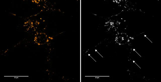 Fluorescent Cell Imaging - FFN102 (Mini 102), Fluorescent DAT and VMAT2 substrate (AB120866)
