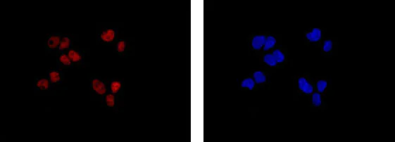 Immunocytochemistry/ Immunofluorescence - Anti-FGD2 antibody [EPR15306] - BSA and Azide free (AB250869)