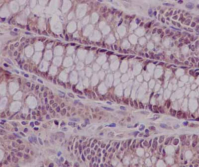 Immunohistochemistry (Formalin/PFA-fixed paraffin-embedded sections) - Anti-FGD2 antibody [EPR15306] - N-terminal (AB185968)