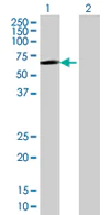 Western blot - Anti-FGD5 antibody (AB67681)