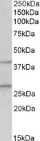 Western blot - Anti-FGF 23 antibody (AB123502), expandable thumbnail