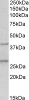 Western blot - Anti-FGF 23 antibody (AB123502)