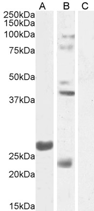 Western blot - Anti-FGF 23 antibody (AB123502), expandable thumbnail