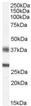 Western blot - Anti-FGF 23 antibody (AB56326)