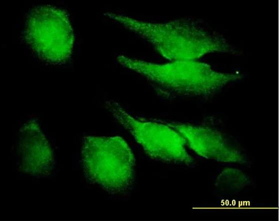Immunocytochemistry/ Immunofluorescence - Anti-FGF1 alpha antibody (AB169748)
