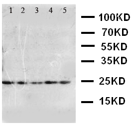 Western blot - Anti-FGF10 antibody (AB115825)