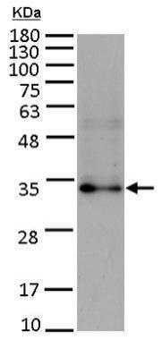 Western blot - Anti-FGF10 antibody (AB227102)