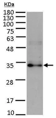 Western blot - Anti-FGF10 antibody (AB227102)
