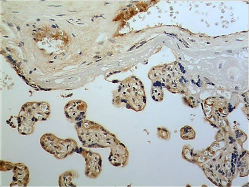Immunohistochemistry (Formalin/PFA-fixed paraffin-embedded sections) - Anti-FGF11 antibody [MM0282-6J20] (AB89713), expandable thumbnail
