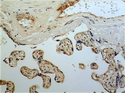 Immunohistochemistry (Formalin/PFA-fixed paraffin-embedded sections) - Anti-FGF11 antibody [MM0282-6J20] (AB89713)