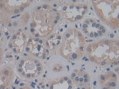 Immunohistochemistry (Formalin/PFA-fixed paraffin-embedded sections) - Anti-FGF12 antibody (AB231956)