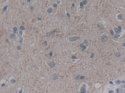 Immunohistochemistry (Formalin/PFA-fixed paraffin-embedded sections) - Anti-FGF12 antibody (AB231956)